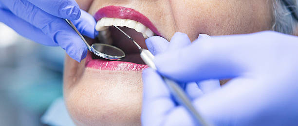 Best Emergency Root Canal Therapy in Mazon, IL